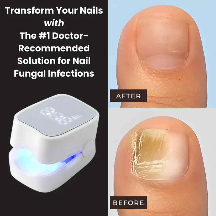 PRIMEDROP™ - Nail Fungus Laser Device